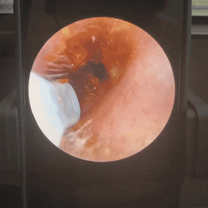 Domvaya VisioEar : Une technologie pour la santé des oreilles approuvée par les médecins