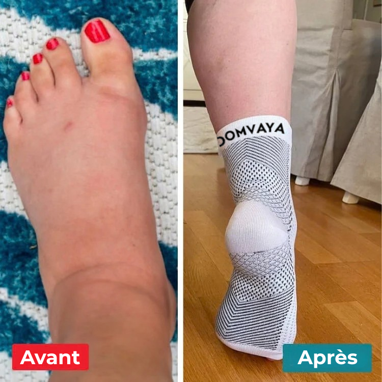 StepEase - Chaussettes Neuropathiques & Compression